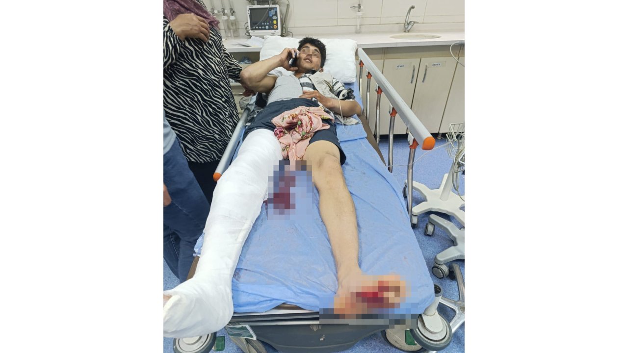 İnek otlatırken ayının saldırısına uğrayan genç yaralandı