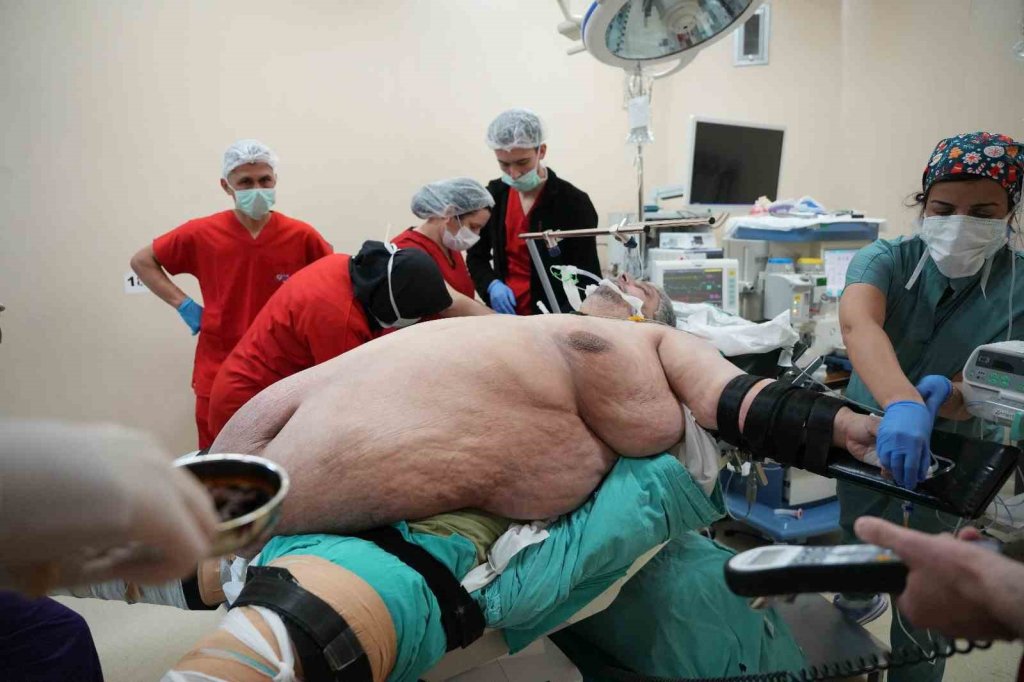 310 kilo ile ve sedye ile geldiği hastaneden yürüyerek çıktı