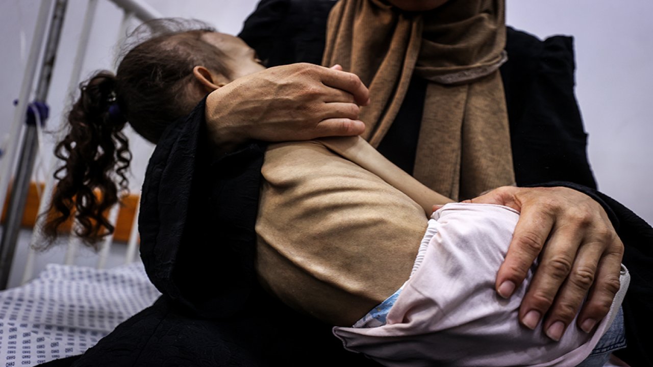 Gazzeli 9 yaşındaki çocuk açlıktan 10 kg'a düştü