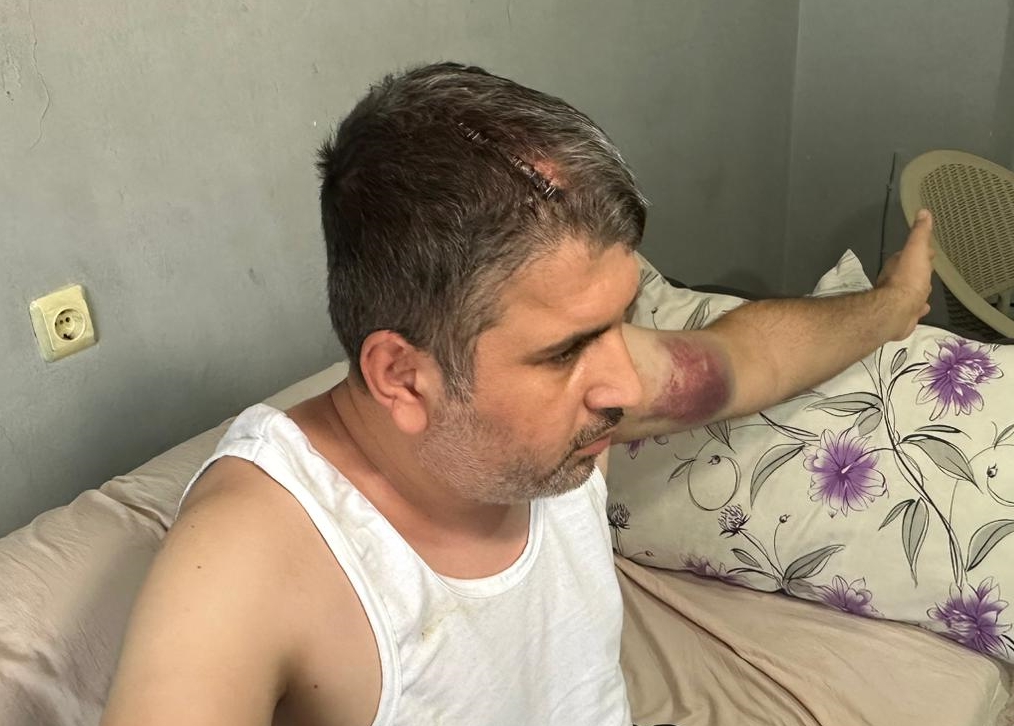 Dayısı yol ortasında beyzbol sopasyıla öldüresiye dövdü