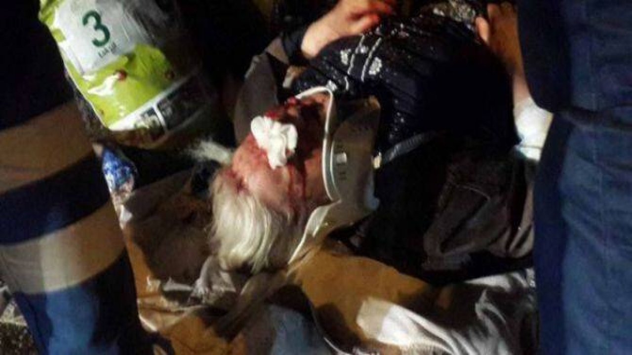 TEM otoyolunda 30 araç birbirine girdi!