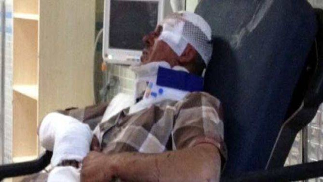 Taşlı sopalı gasp