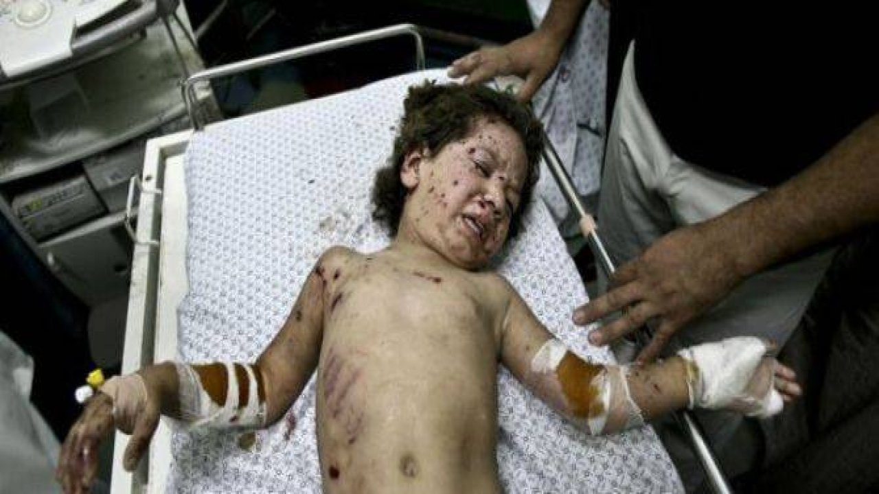 Gazzeli çocuk elinde çikolatasıyla öldü