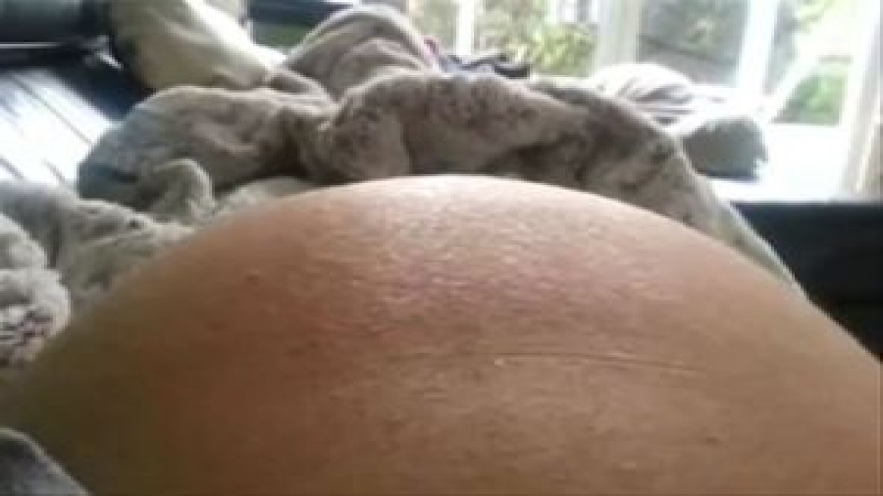 Anne Karnındaki Bebeğin Hareketi Şaşırttı