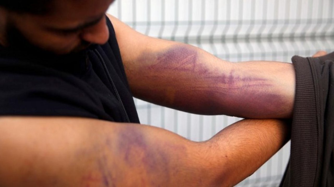 Düzensiz göçmenler konuştu: Yunan askerleri beni tüfekle dövdü