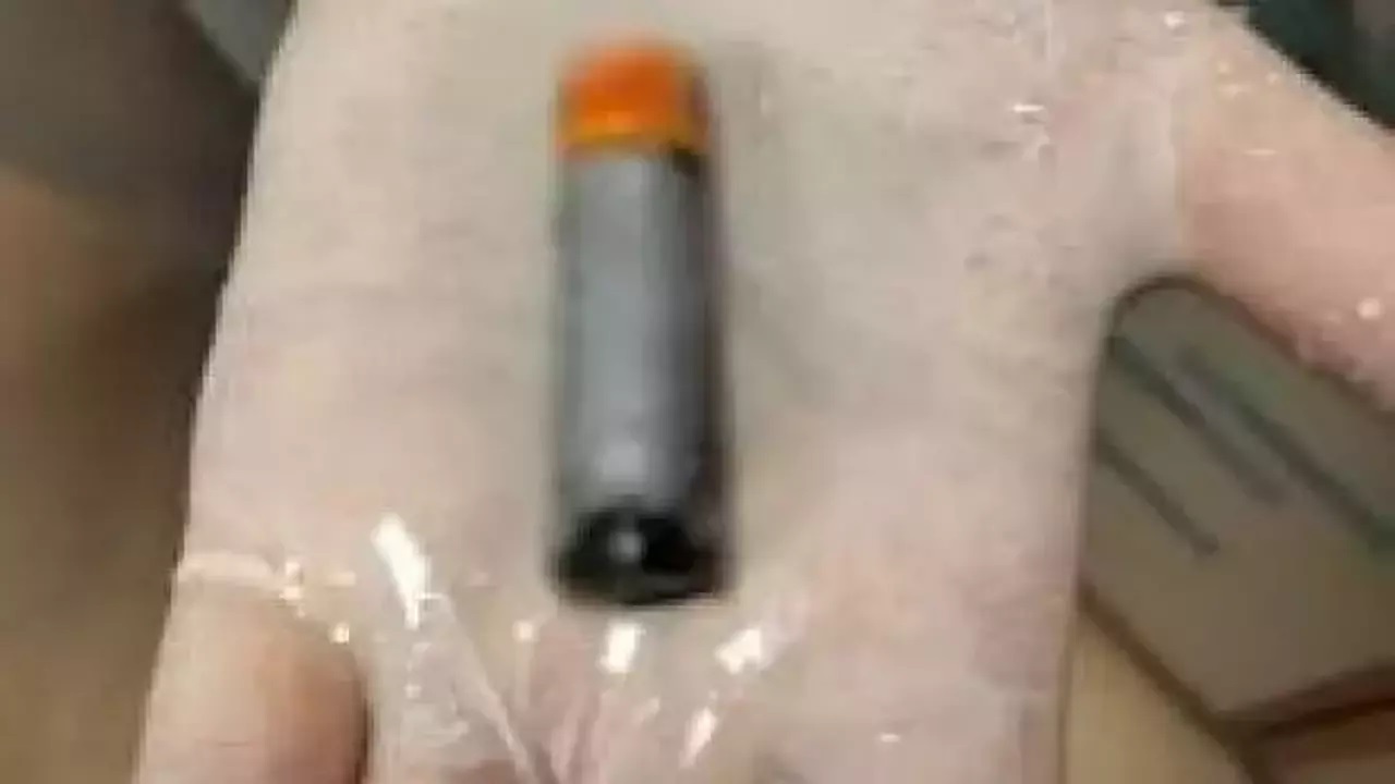 Midesinden çıktı! Doktorları şoke etti