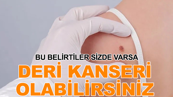 Bu belirtiler sizde varsa deri kanseri olabilirsiniz