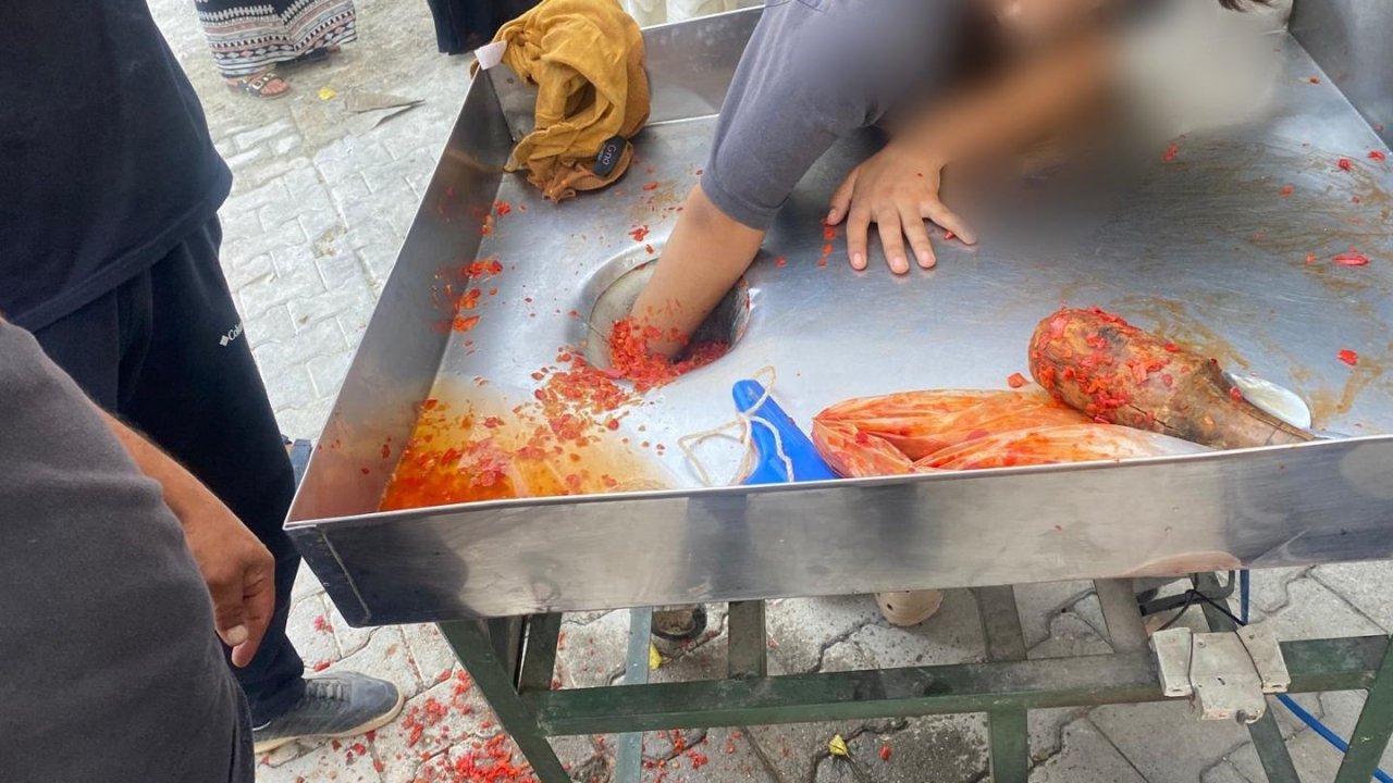 Kız çocuğu elini salça makinesine kaptırdı