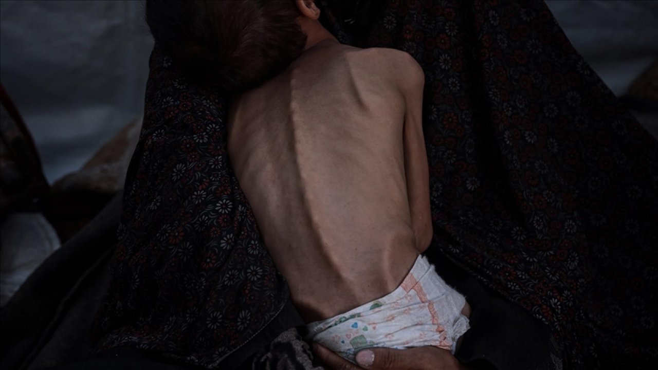 Gazze'de insanlar açlıktan ölüyor