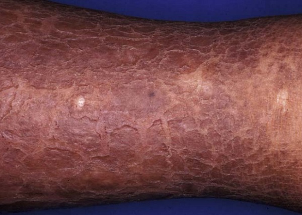 Cildin gençliğini korumak için 4 altın kural