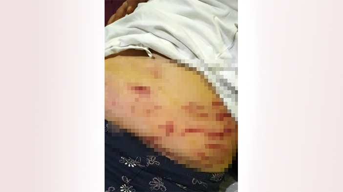 Sokakta ağızlıksız gezdirdi: Dehşet saçtı, kuryeyi yaraladı (VİDEOLU)