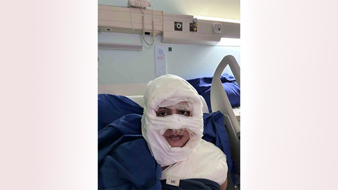 Hiç tanımadığı bir kadın tarafından ateşe verildi