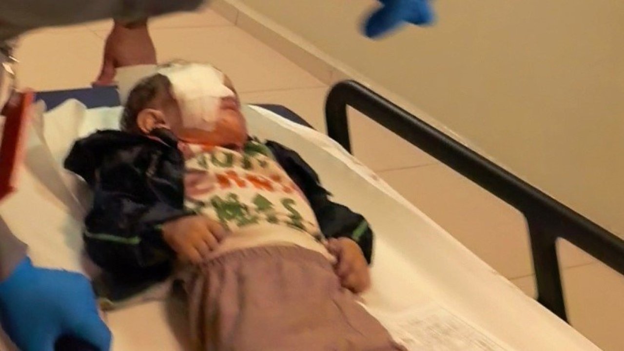 Torpil patlatan 2 yaşındaki çocuk kör oldu