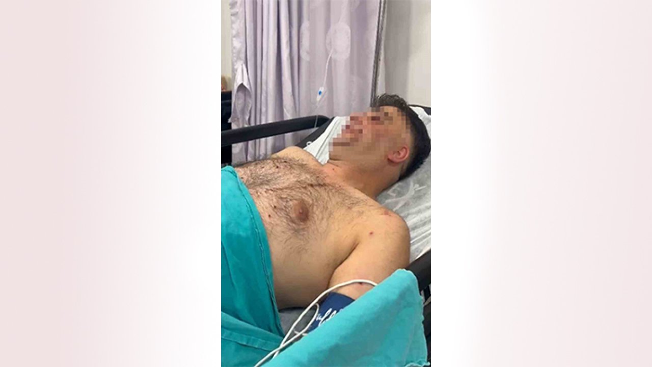 Pompalı tüfekle çevreye rastgele ateş açtı: Çeşit çeşit suç kaydı varmış