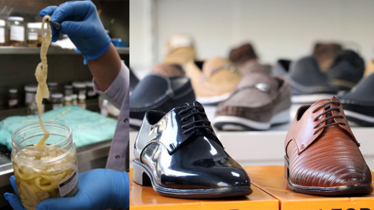 'Kancalı kurt hastalığı' 1980 yılından sonra bir daha görülmedi: Toprağa yalınayak basan vatandaşlar arasında yayılıyordu