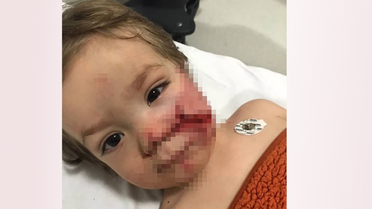 Başıboş köpek dehşet saçtı! Ankara’da pitbull bebeğin yüzünü paramparça etti!