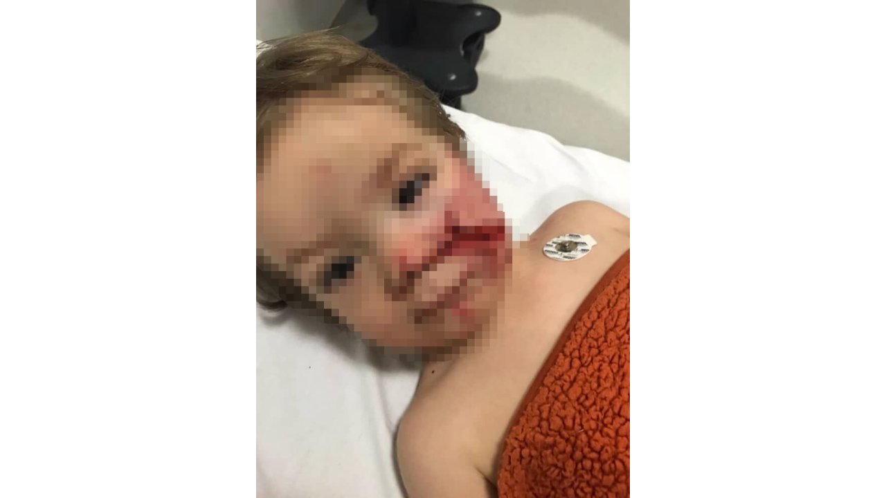 Ankara'da sitede pitbull dehşeti!