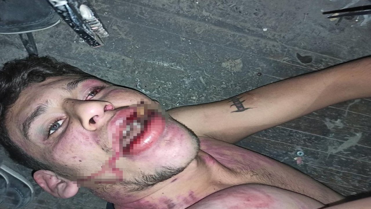 Hamam böceği yedirilen gencin dosyasında karar: Yağmadan beraat, hürriyeti tehditten 6 yıl 2 ay ceza