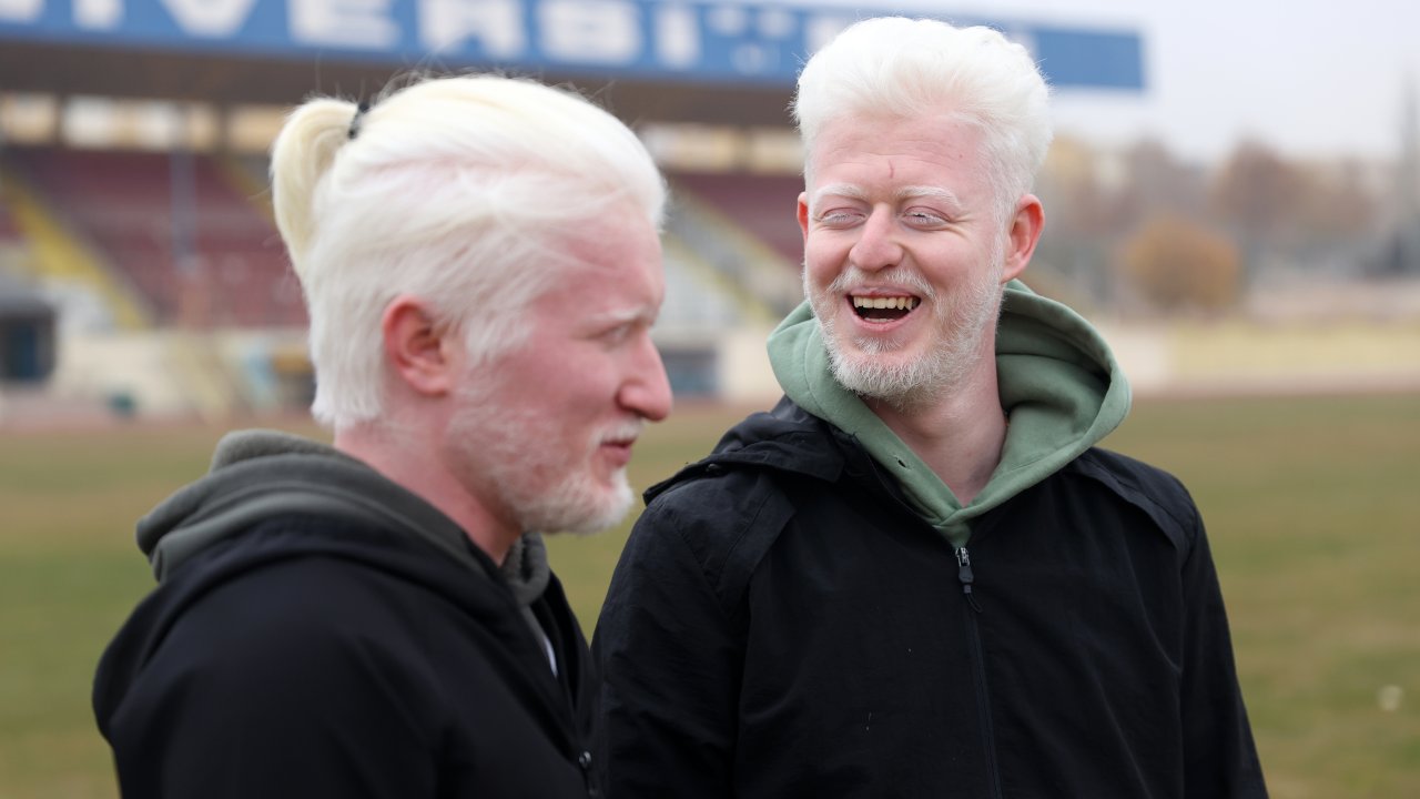 Selçuk Üniversitesinde okuyan "Albinizmli" arkadaşlar ilham olmak istiyor