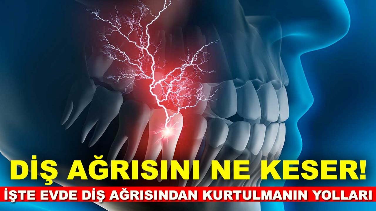 Diş ağrısını ne keser! İşte evde diş ağrısından kurtulmanın yolları