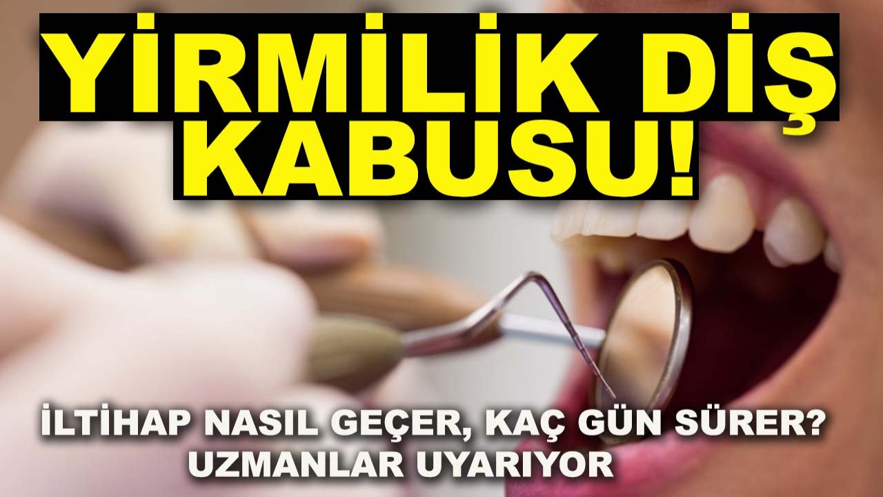 Yirmilik diş kabusu! İltihap nasıl geçer, kaç gün sürer? Uzmanlar uyarıyor