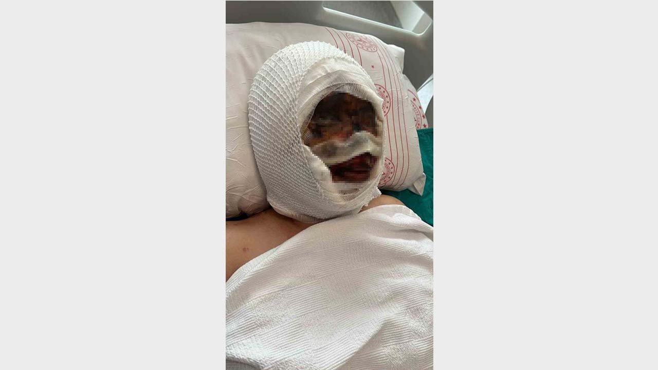 Eski eşi tarafından vahşete uğrayan kadın o anları anlattı, acılı baba sert tepki gösterdi