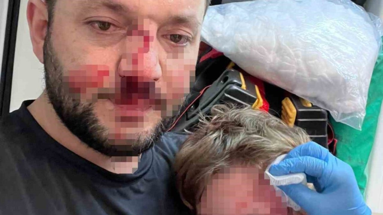 Kucağındaki bebeğiyle saldırıya uğradı! 14 aylık İkra’nın kafatası çatladı