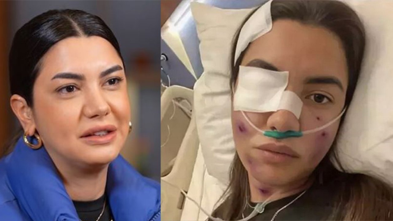 Gözleri bantlı yüzü yaralı! 5 bin kişi 'geçmiş olsun' dedi: Fulya Öztürk ile gerçek başka çıktı