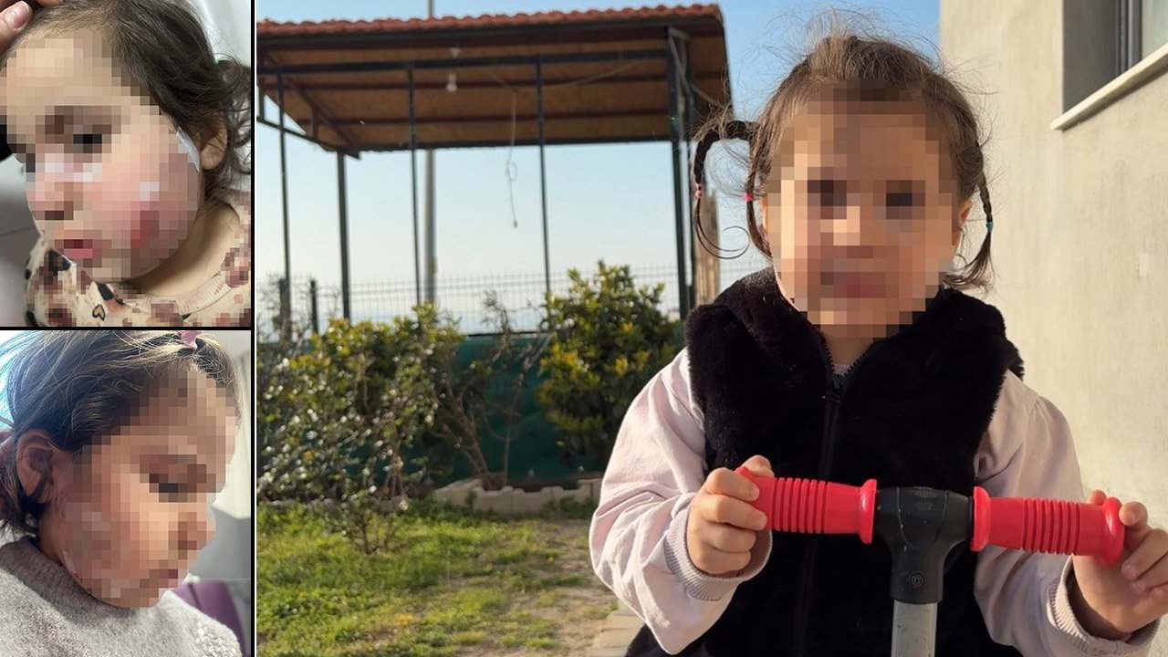Dehşetin adresi bu kez İzmir! Küçük kızın yüzünü parçaladılar