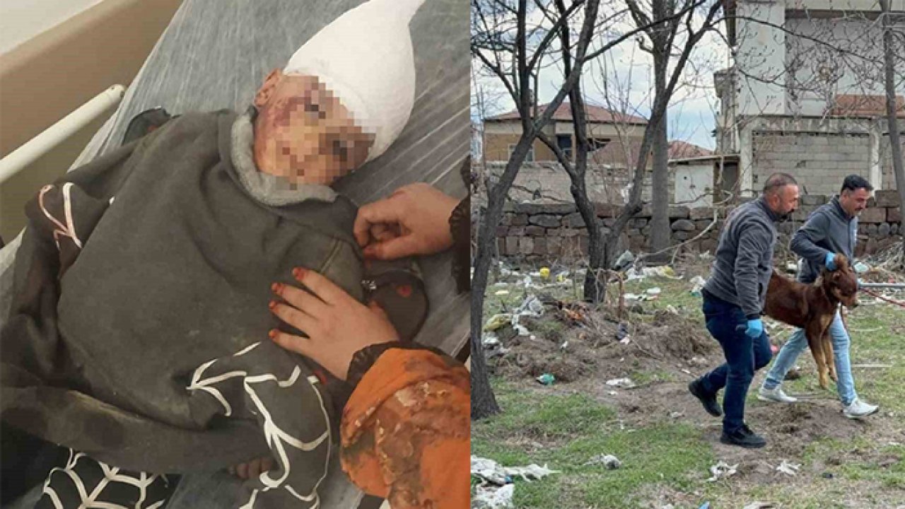 3 yaşındaki çocuğa köpek saldırdı: 3 kez ameliyat oldu, 12 gündür hastanede savaş veriyor