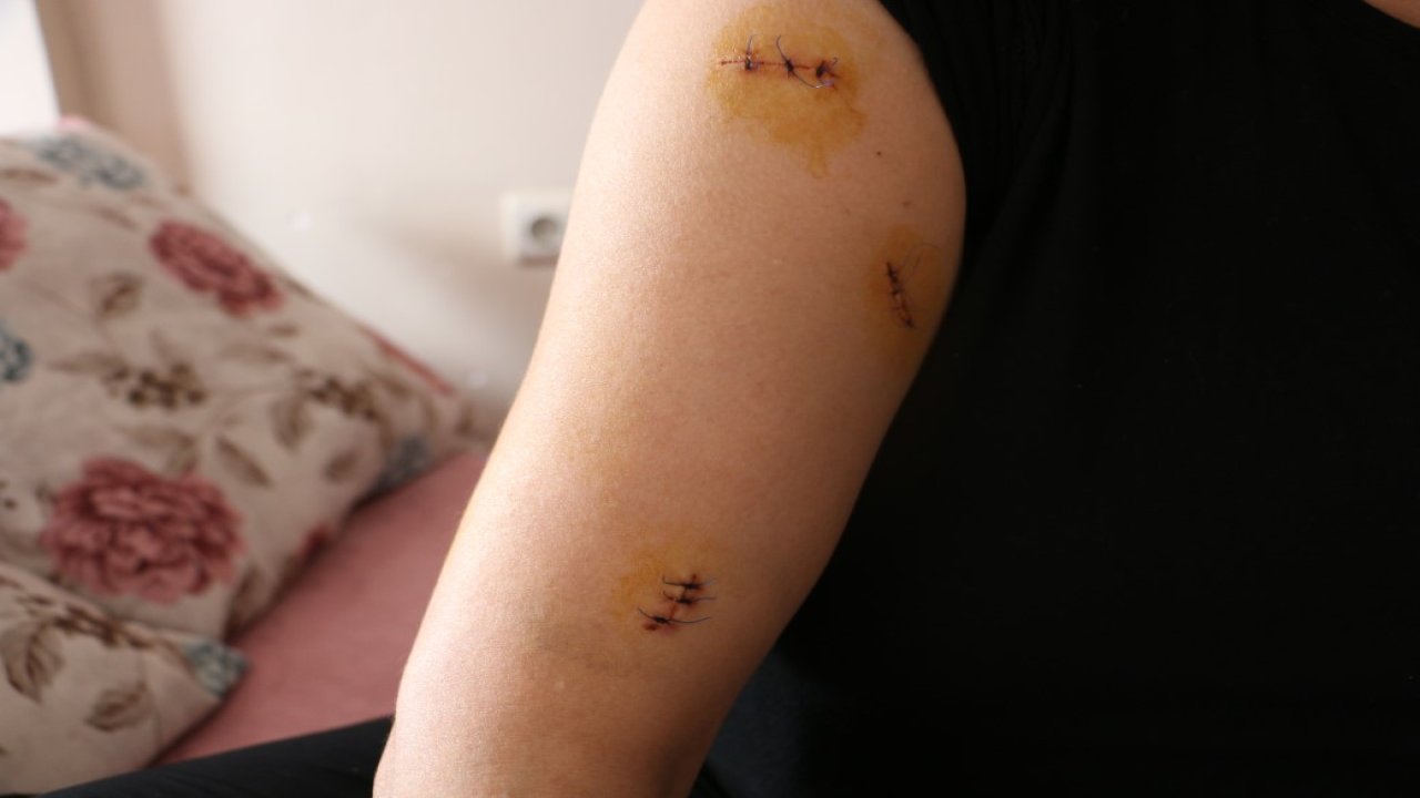 Diyarbakır’da kan donduran olay! Nikahlı eşini 30 yerinden bıçakladı