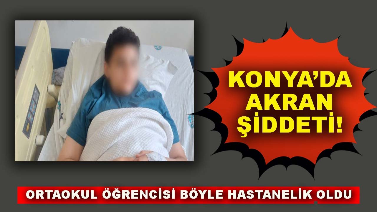 Konya’da akran şiddeti! Ortaokul öğrencisi böyle hastanelik oldu