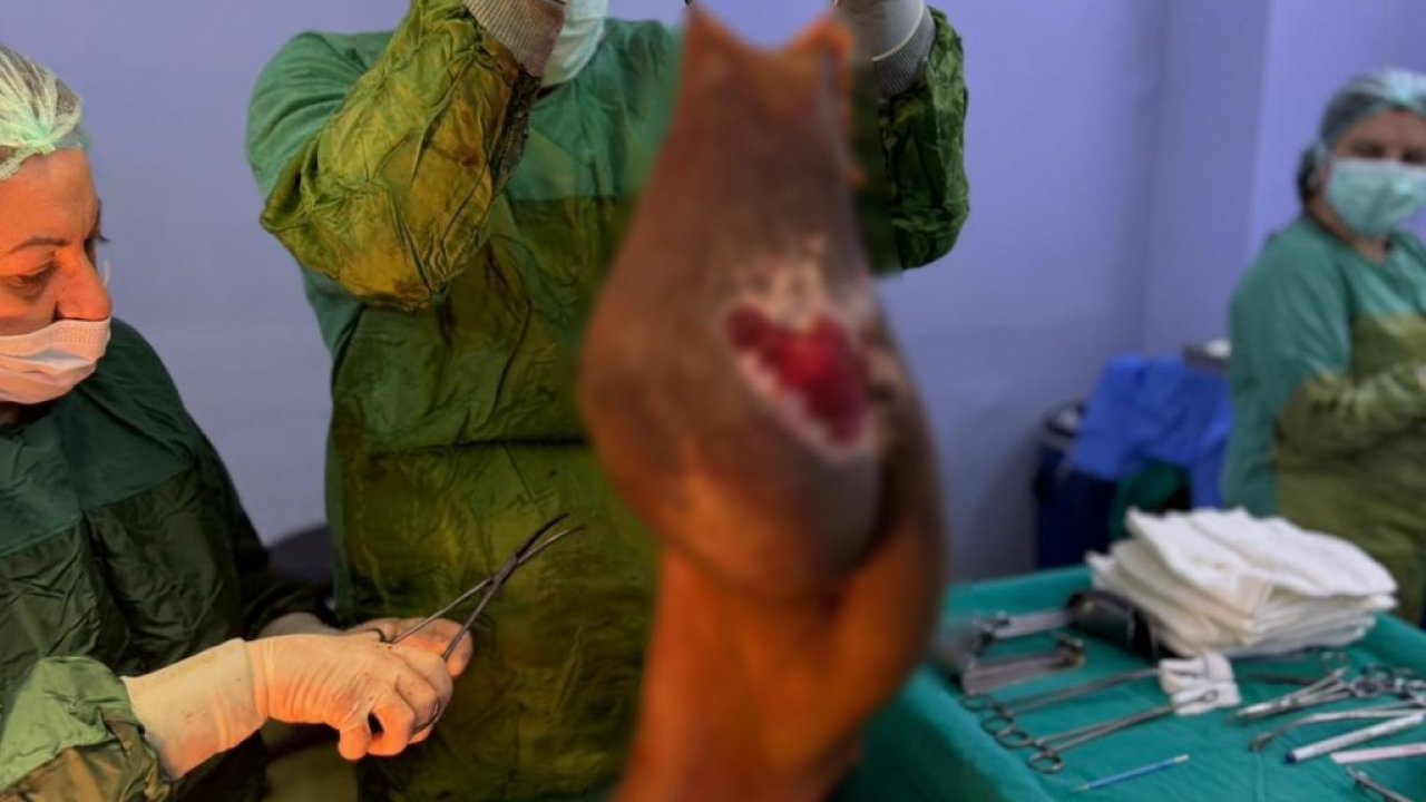 Karnından 40 kilogram kitle çıkarıldı