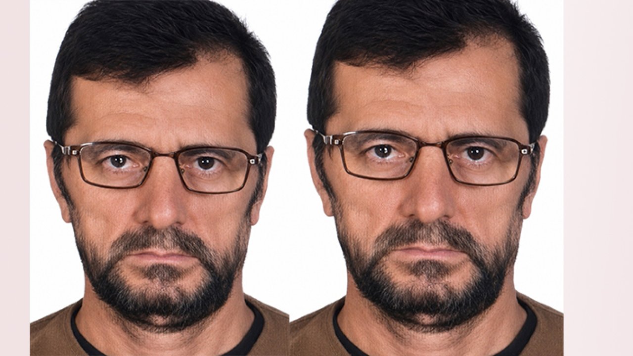 Fındık bahçesinde yanmış halde ölü bulundu