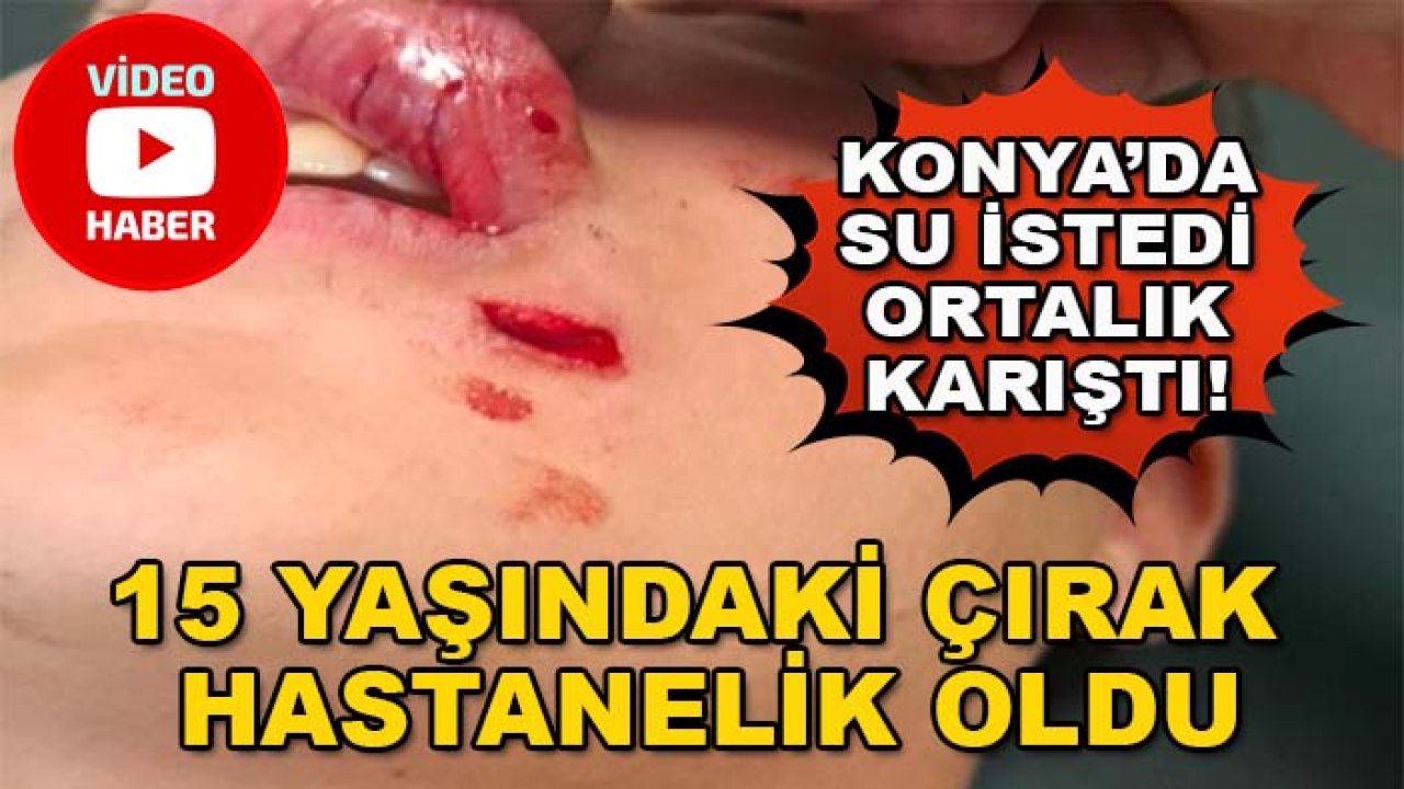 Konya’da su istedi, ortalık karıştı! 15 yaşındaki çırak hastanelik oldu