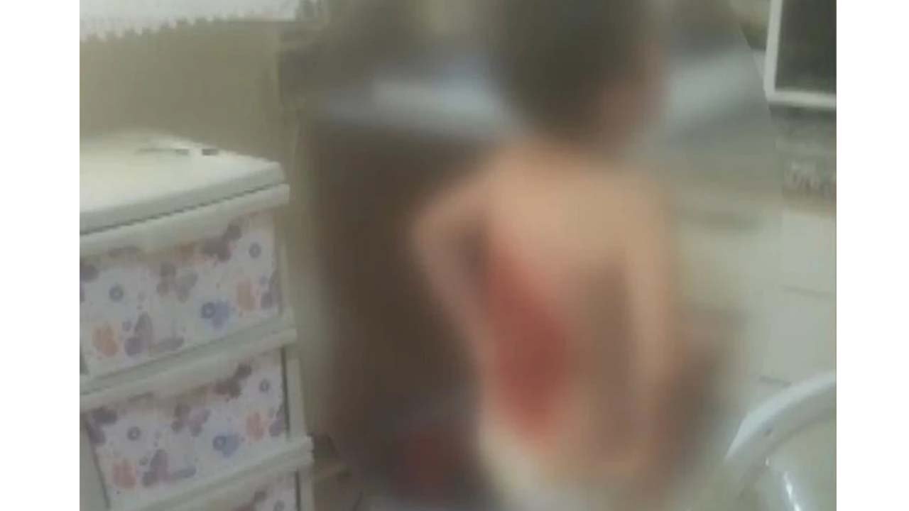 12 yaşındaki çocuğa korkunç tuzak! Sırtını kolonya döküp yaktılar