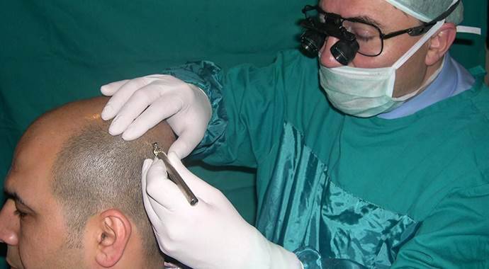 Saç ekiminde ameliyathane uyarısı