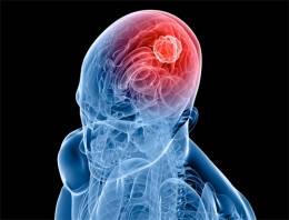 Daha zeki olmanız mümkün mü?