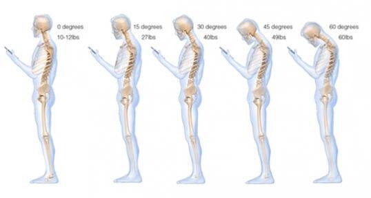 Akıllı telefonlar kambur yaptı sağlımız tehlikede