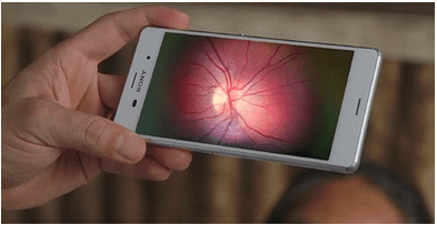 Göz Muayenesi İçin Hastaneye Lüzum Yok Telefon Olsun Kafi