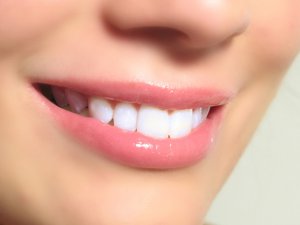 Dişlerdeki Lekeler Nasıl Geçer? Diş Sarılığının Çözümü Ne?