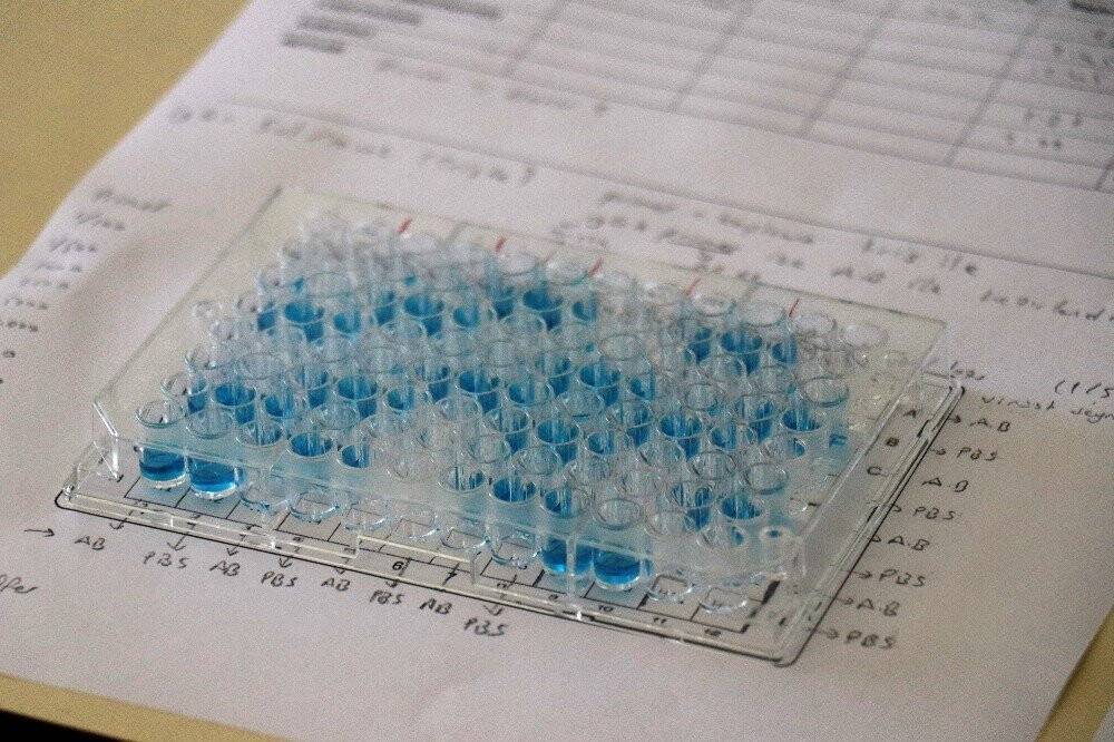 Koronavirüse yeni test