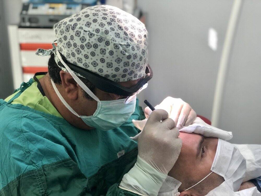 Saç ekimi özgüveni artırıyor