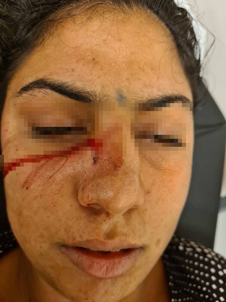 Adana'da dini nikahlı eşini darbedip bıçaklayan koca tutuklandı