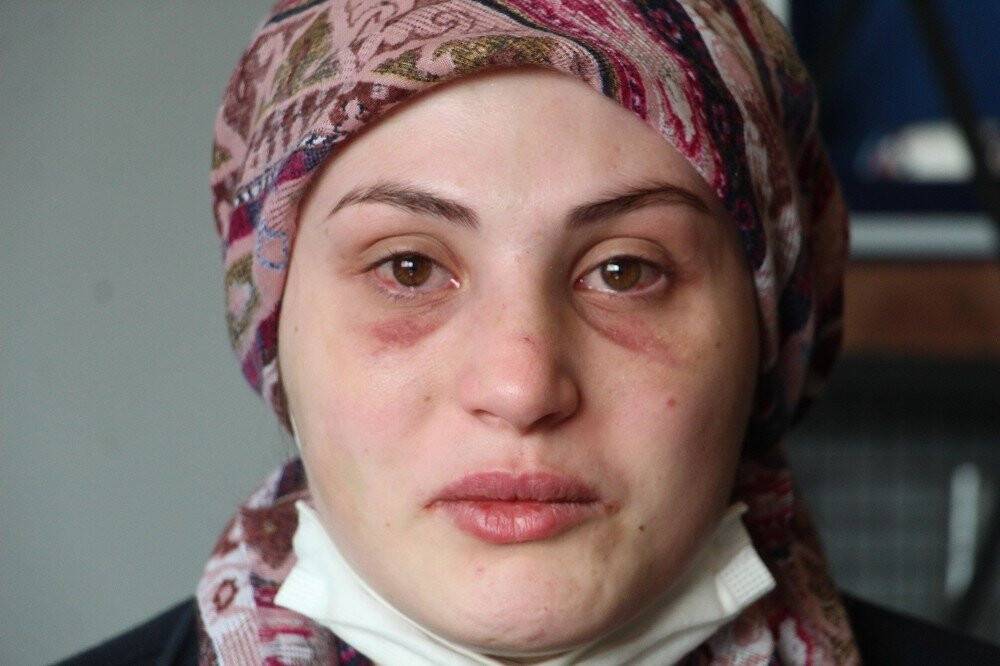 Kaçarak evlendiği eşi, genç kadına kabusu yaşattı