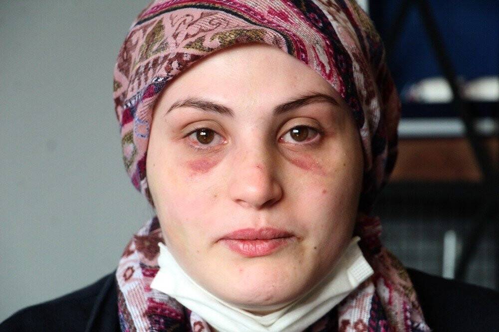 Kaçarak evlendiği eşi, genç kadına kabusu yaşattı
