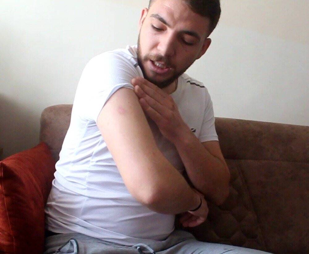 Patlayan cep telefonu yaraladı