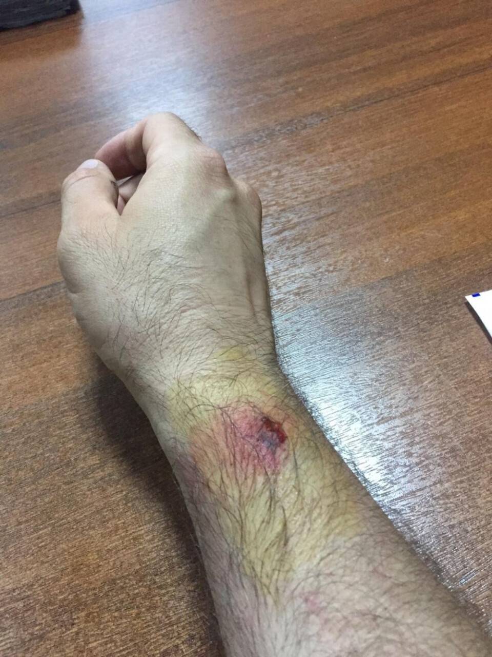Parayı kaptırdı komiserin kolunu ısırdı