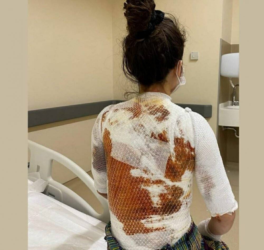 Eşinin kaynar suyla yaktığı Rukiye A: Ölmek istemiyorum