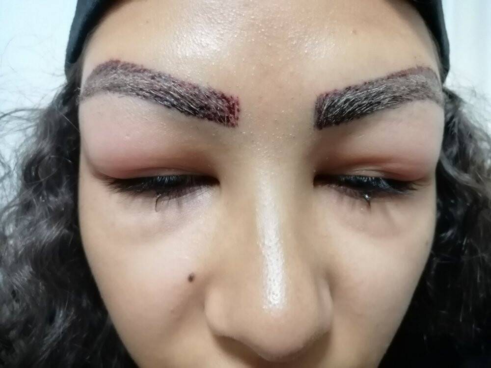 Reklam yüzü olmak için gitti, yüzünden oldu